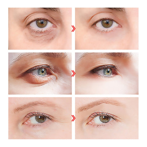 Bosein Active Eye Serum Facial Anti-wrinkle-BH00197-Veeddydropshipping