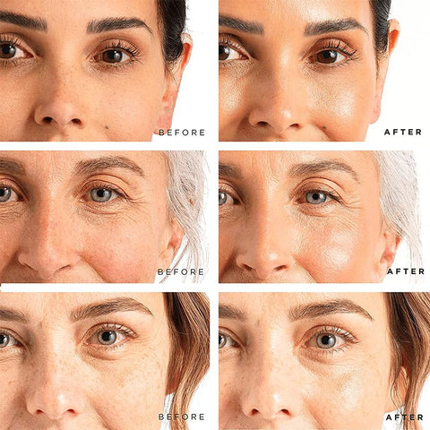 Serum Liquid Coenzyme  Acid And Anti-wrinkles-BH00226-Veeddydropshipping