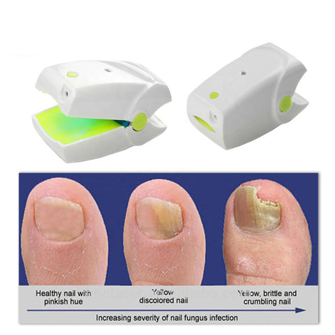 painless nail fungus therapeutic instrument Laser foot care-BH00883-Veeddydropshipping
