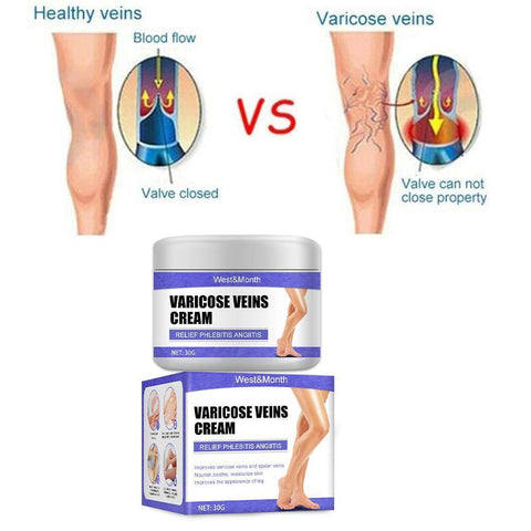 Treatment Cream Relieve Tired Legs Dilated-BH00299-Veeddydropshipping