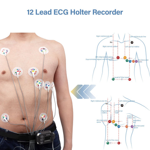 24-hour Dynamic Electroc ardiogram-BH00799-Veeddydropshipping