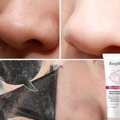 Strawberry Nose Oil  Mask Cream Skin Care-BH00234-Veeddydropshipping